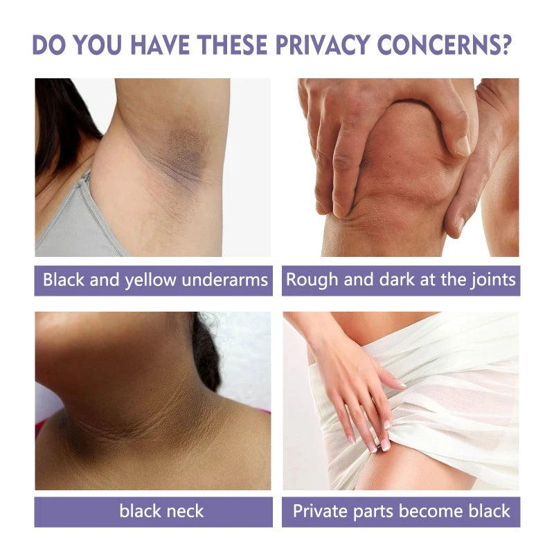 Skin Beauty Stick Moisturizing Reduce Melanin Underarm Knee Whitening Brighten Skin Repair Care Cream Lighten Body Melanin Stick