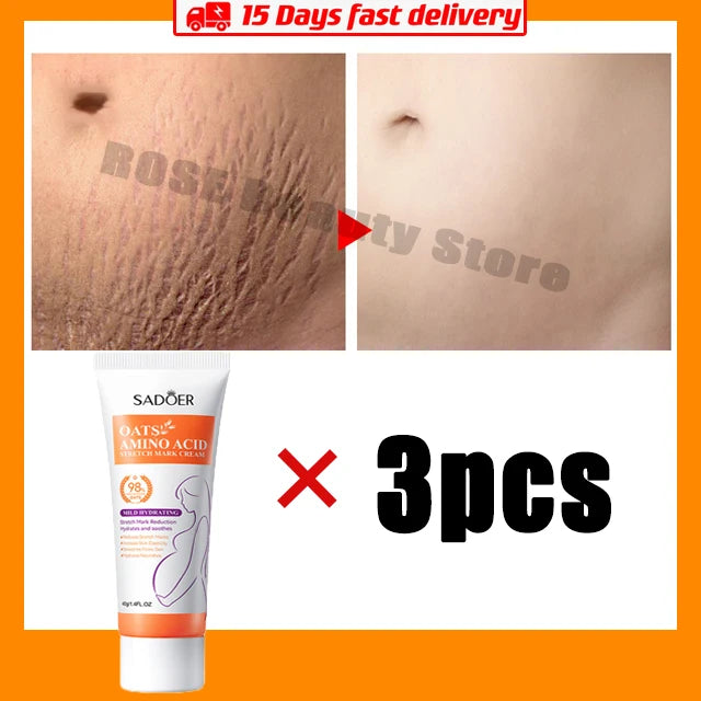 Stretch Marks Permanent Removal Cream Eliminate Body Belly Stretch Marks Swelling Marks Remove Skin Cracks Repair Firming Care