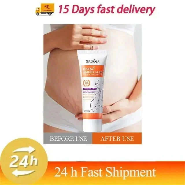 Stretch Marks Permanent Removal Cream Eliminate Body Belly Stretch Marks Swelling Marks Remove Skin Cracks Repair Firming Care