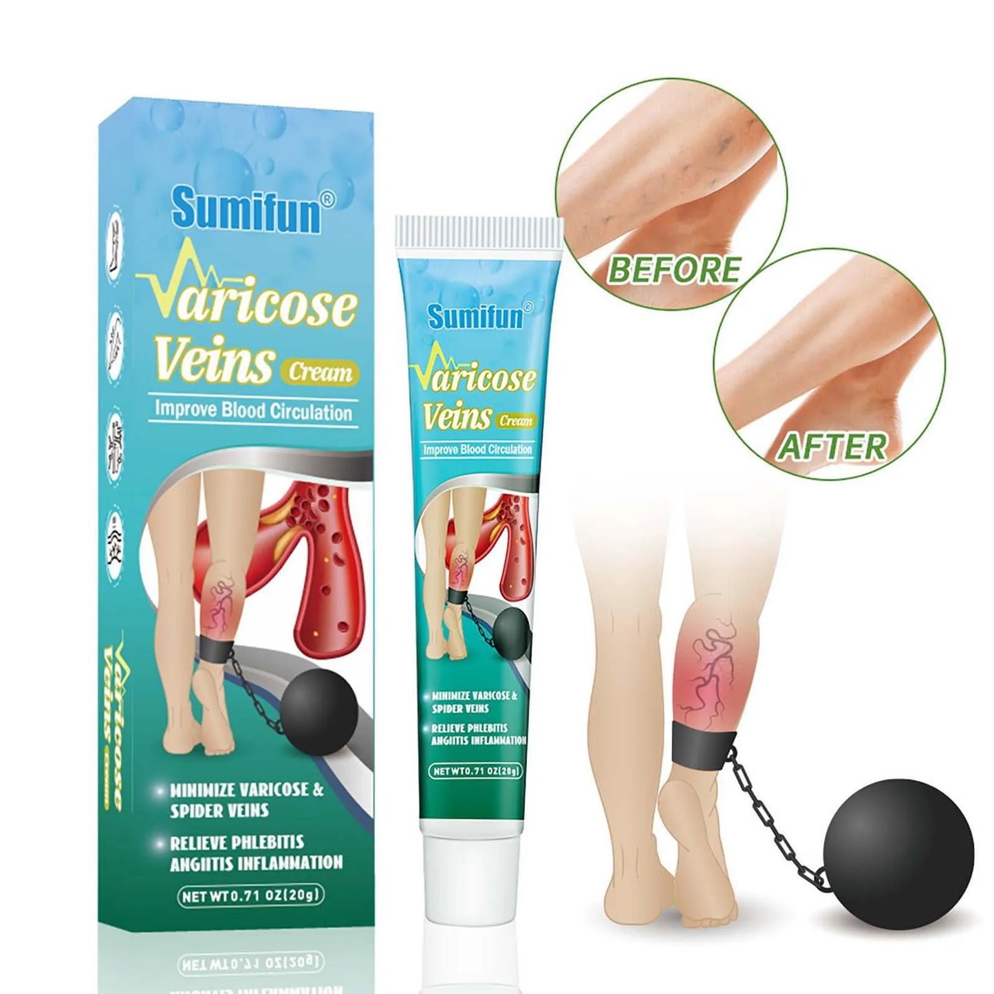 Varicose Vein Relief ,Improve Blood Circulations Spider Varicose Vein For Tired Heavy Legs Fast Relief Partijbenodigdheden