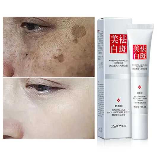 Whiten Cream Effective Brighten Face For Face Improve Dullness Dark Spot Melasma Anti-pigmentation Spots Remove Skin Care Cream