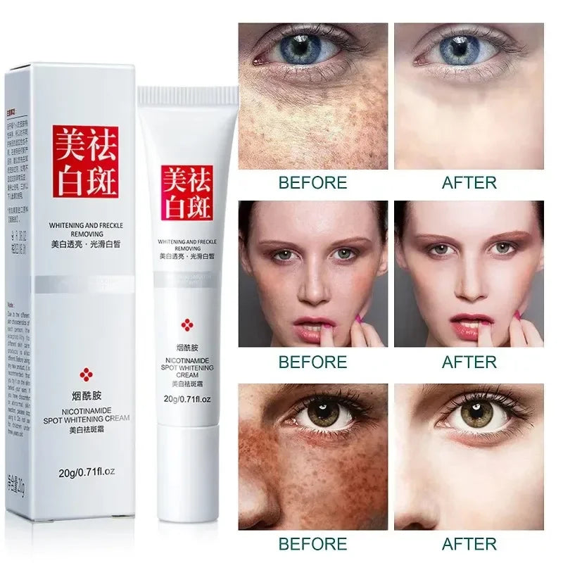 Whiten Cream Effective Brighten Face For Face Improve Dullness Dark Spot Melasma Anti-pigmentation Spots Remove Skin Care Cream