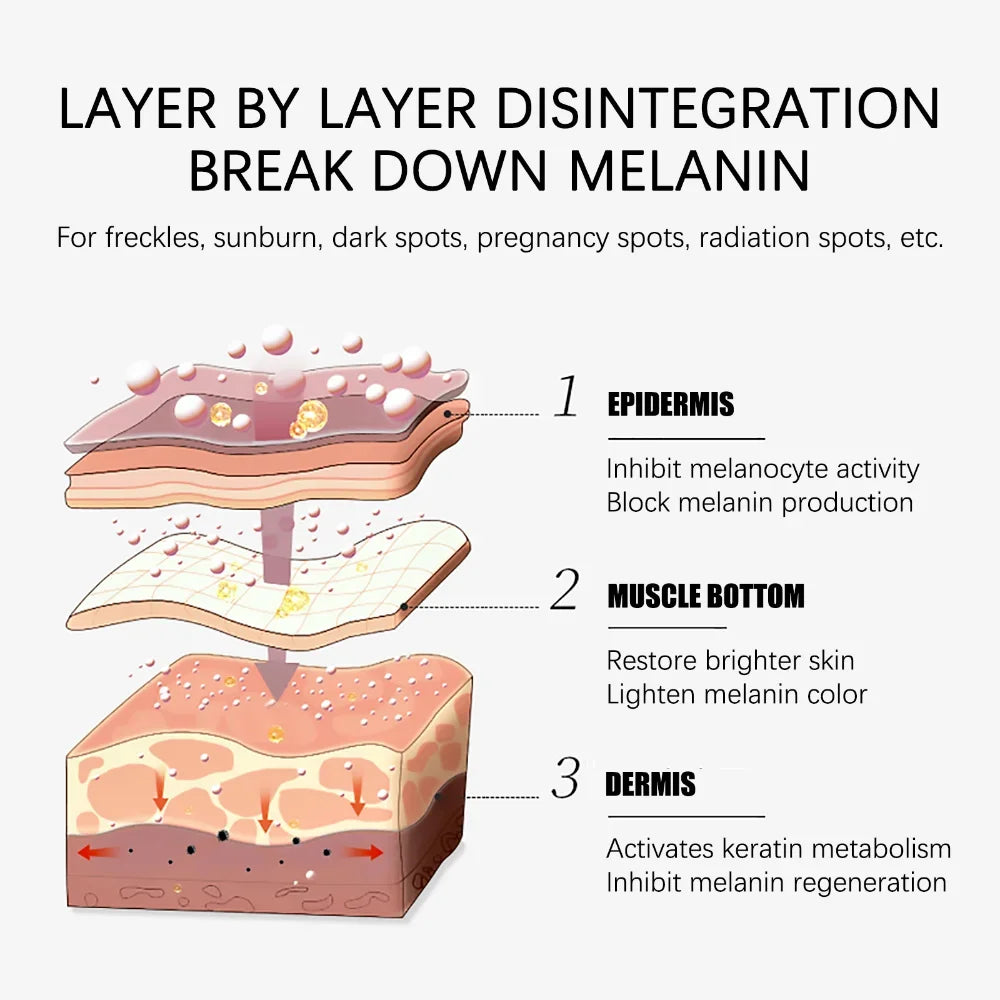 Whiten Cream Effective Brighten Face For Face Improve Dullness Dark Spot Melasma Anti-pigmentation Spots Remove Skin Care Cream