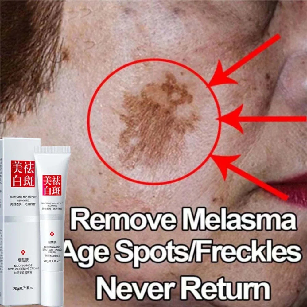 Whiten Cream Effective Brighten Face For Face Improve Dullness Dark Spot Melasma Anti-pigmentation Spots Remove Skin Care Cream