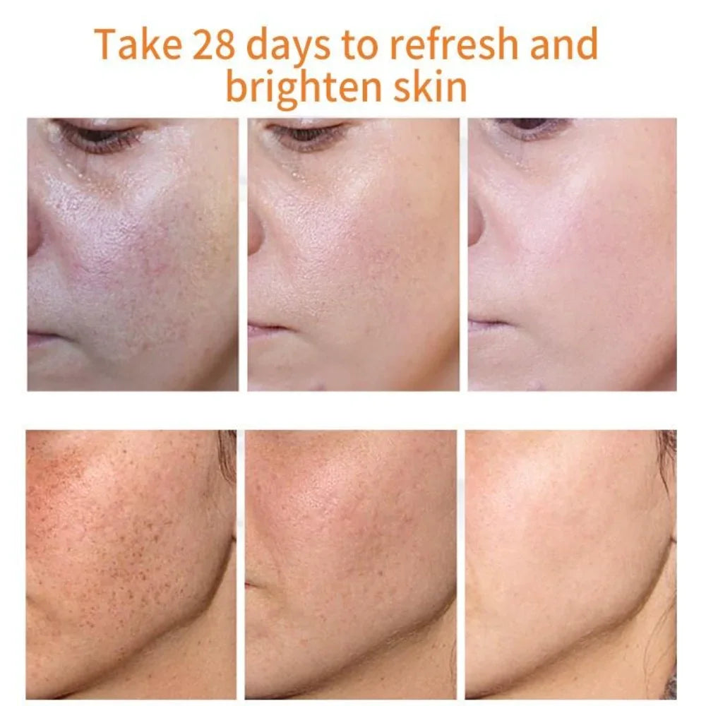 Whiten Cream Effective Brighten Face For Face Improve Dullness Dark Spot Melasma Anti-pigmentation Spots Remove Skin Care Cream