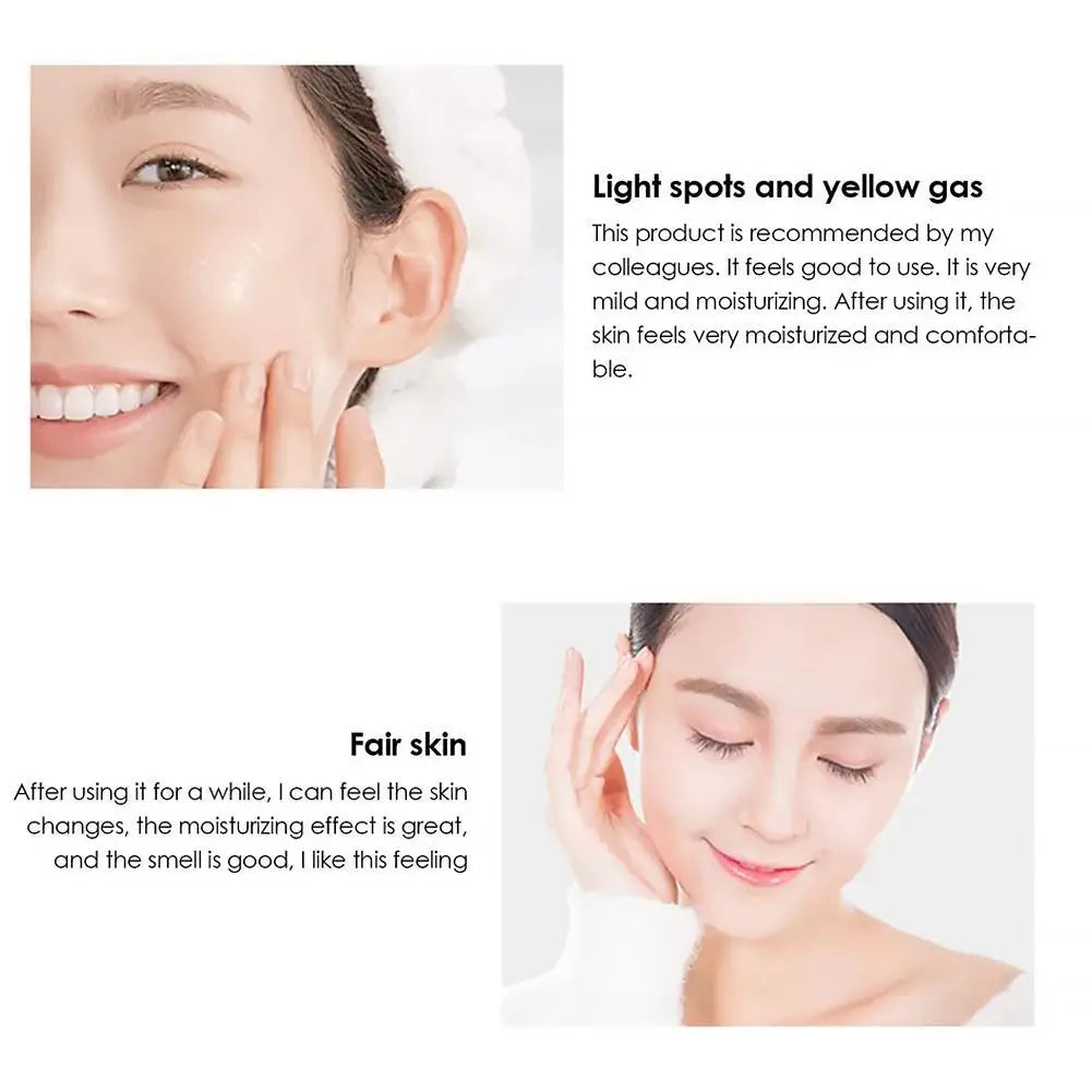 Whitening Cream Anti Freckle Face Cream, Remove The Black，Melasma Dark Spot Acne Deposits On The Skin,Brighten Skin Care؜
