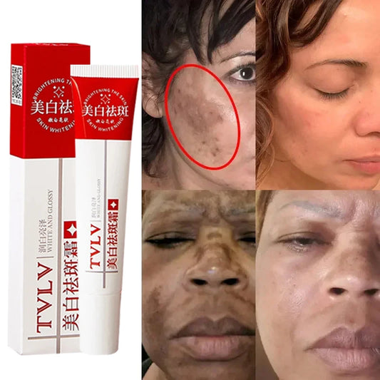 Whitening Freckle Cream Dark Spots Pigmentation Remover Moisturizing Facecare Lighten Melanin Repair Brighten Korean Cream