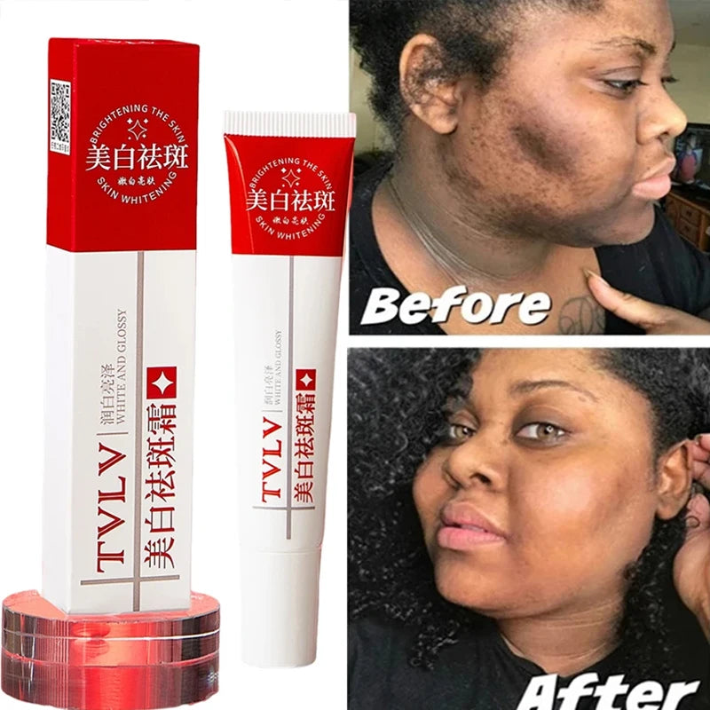 Whitening Freckle Cream Dark Spots Pigmentation Remover Moisturizing Facecare Lighten Melanin Repair Brighten Korean Cream