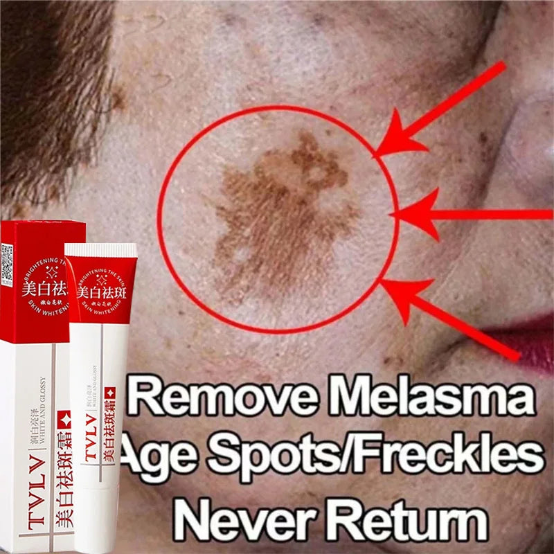 Whitening Freckle Cream Dark Spots Pigmentation Remover Moisturizing Facecare Lighten Melanin Repair Brighten Korean Cream