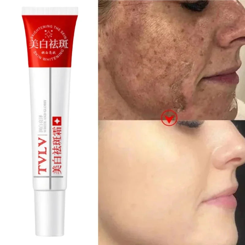 Whitening Freckle Cream Melasma Dark Spots Pigmentation Removal Product Fade Stain Melanin Fast Repair Brighten Korean Skin Care