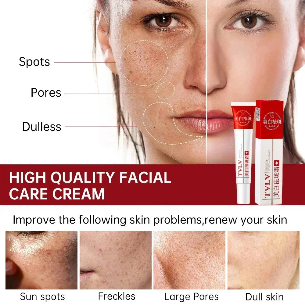 Whitening Freckle Cream Melasma Dark Spots Pigmentation Removal Product Fade Stain Melanin Fast Repair Brighten Korean Skin Care