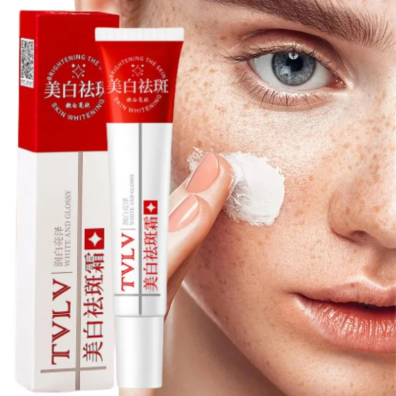 Whitening Freckle Cream Melasma Dark Spots Pigmentation Removal Products Fade Stain Melanin Repair Brighten Korean Skin Care
