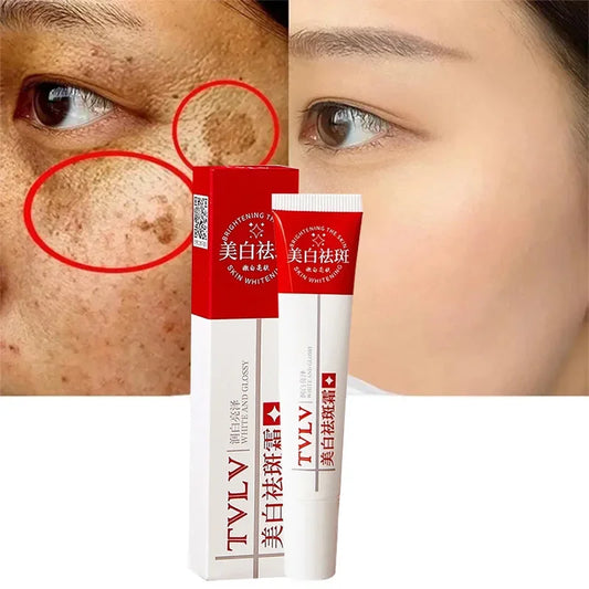 Whitening Freckle Cream Remove Melasma Dark Spots Lighten Remover Moisturizing Brightening Korean Skin Care