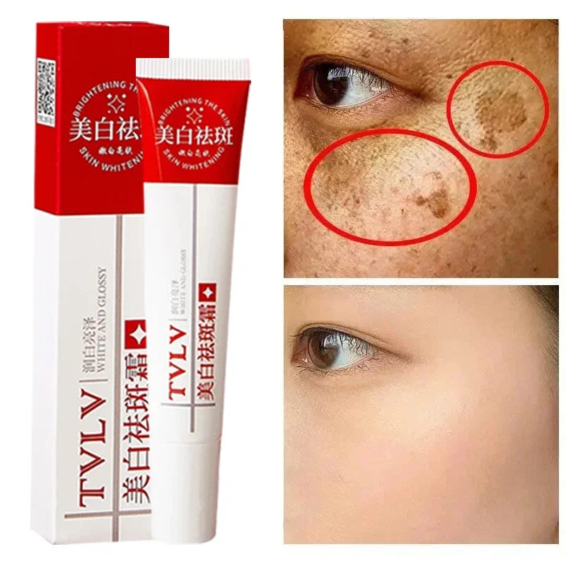 Whitening Freckle Cream Remove Melasma Dark Spots Lighten Remover Moisturizing Brightening Korean Skin Care