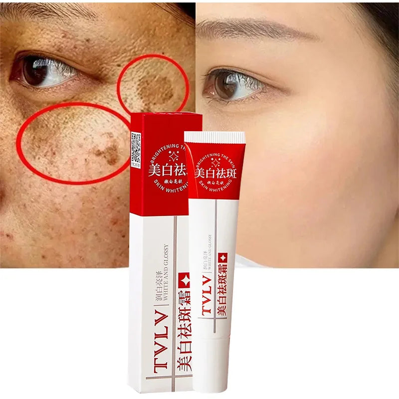 Whitening Freckle Cream Remove Melasma Dark Spots Pigmentation Fade Stain Melanin Repair Brighten Korean Skin Care  Products