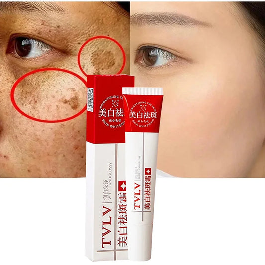 Whitening Freckle Cream Remove Melasma Dark Spots Pigmentation Fade Stain Melanin Repair Brighten Korean Skin Care  Products