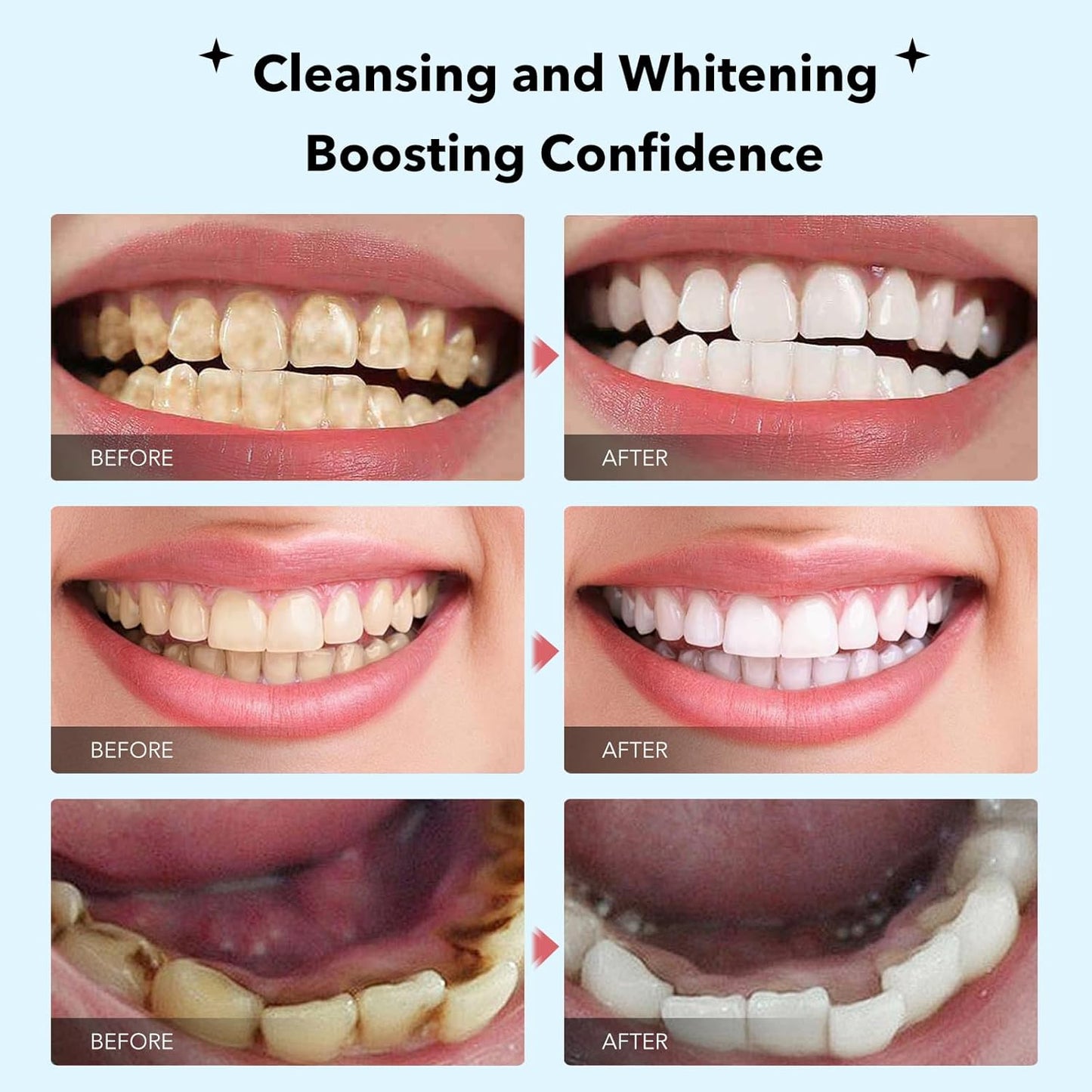 Sale!! SP-6 Ultra Probiotics Whitening Toothpastes, Deep Cleansing for Coffee Stain, Tea Stain, Wine Stain, Bad Breath, Oral PH Balance-1 Pack