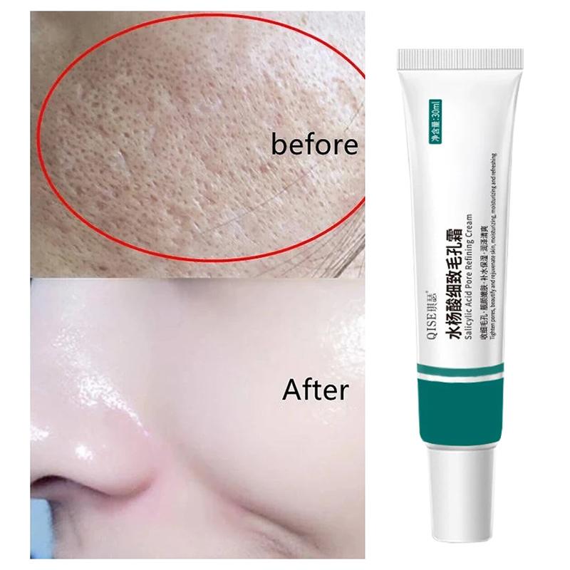 Salicylic Acid Pore Shrinking Cream Large Pores Tightening Repairing Serum Moisturizing Oil Control Skin Care Cosmetic 2024