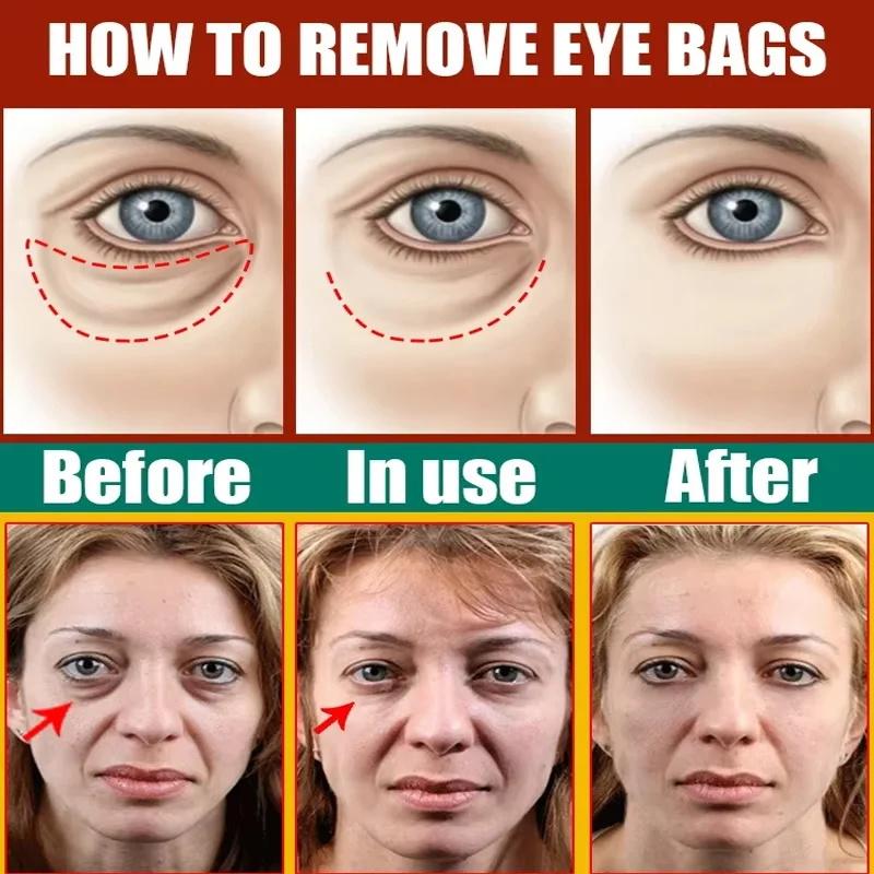 Instant Eye Bag Removal Cream Collagen Anti-Wrinkle Fade Fine Lines Firming Skin Anti Dark Circle Puffiness Brighten Eye Care