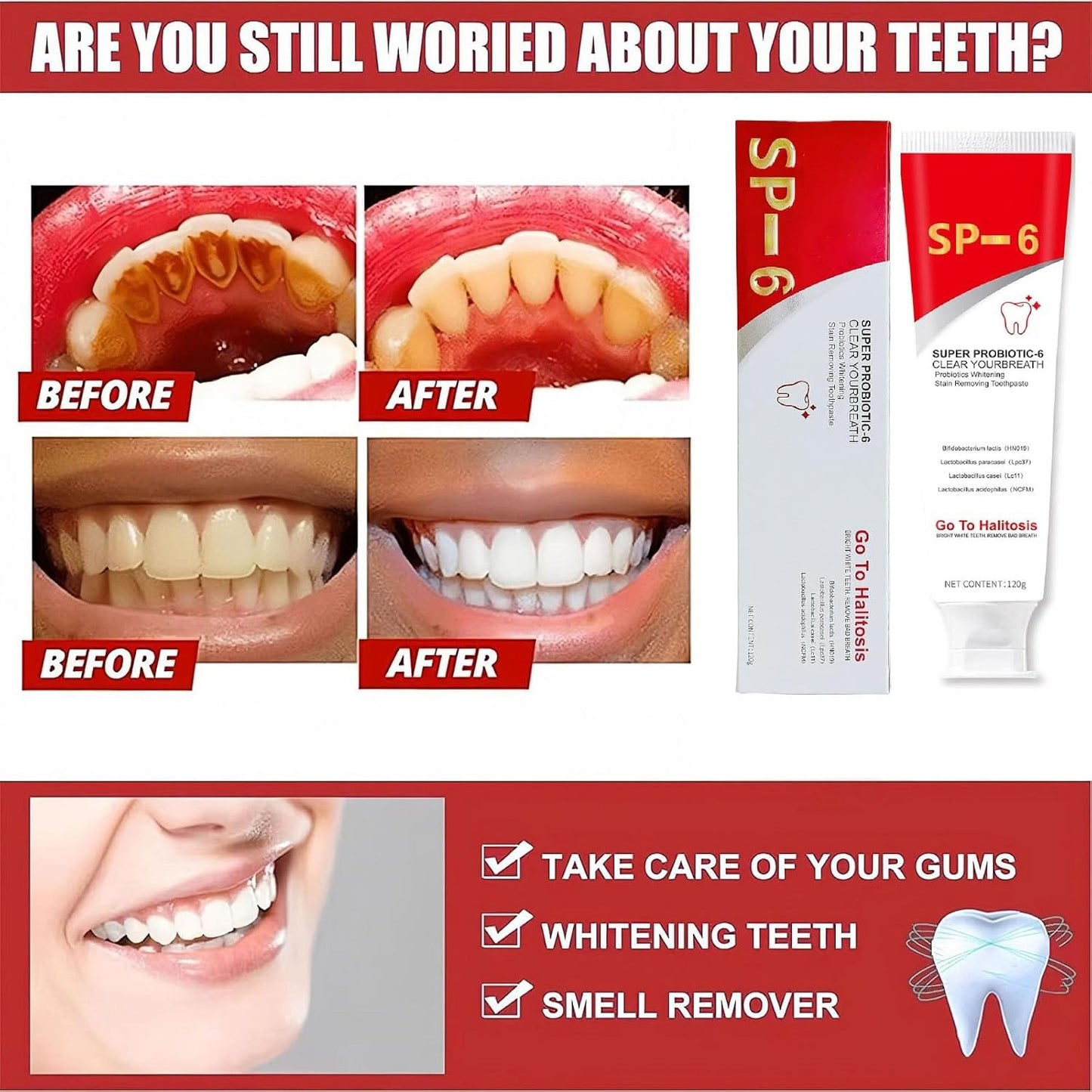 SP-6 Ultra Whitening Toothpaste,Deep Cleaning Care Fresh Breath Super Probiotic-6 Toothpaste with Probiotic Oalance Oral Microbiot. (1 Pcs)