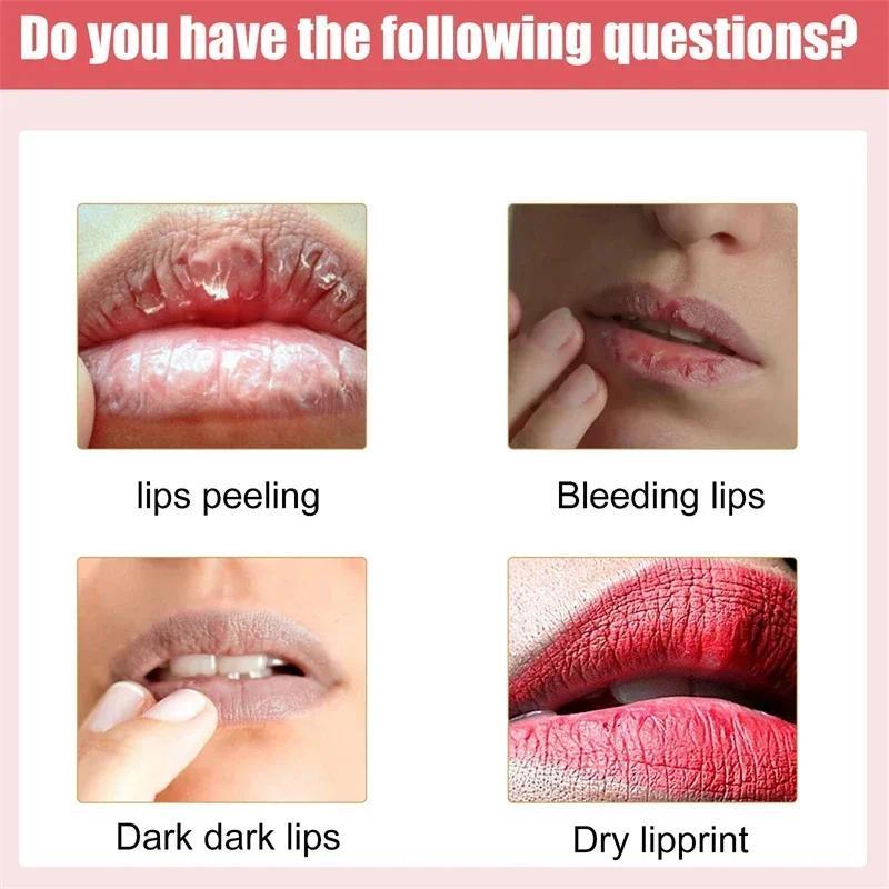 Remove Dark Smoke Lips Pink Fresh Lightening Bleaching Cream Treatment Lip Balm Whitening Moisturizer Nourishing Essence Lips