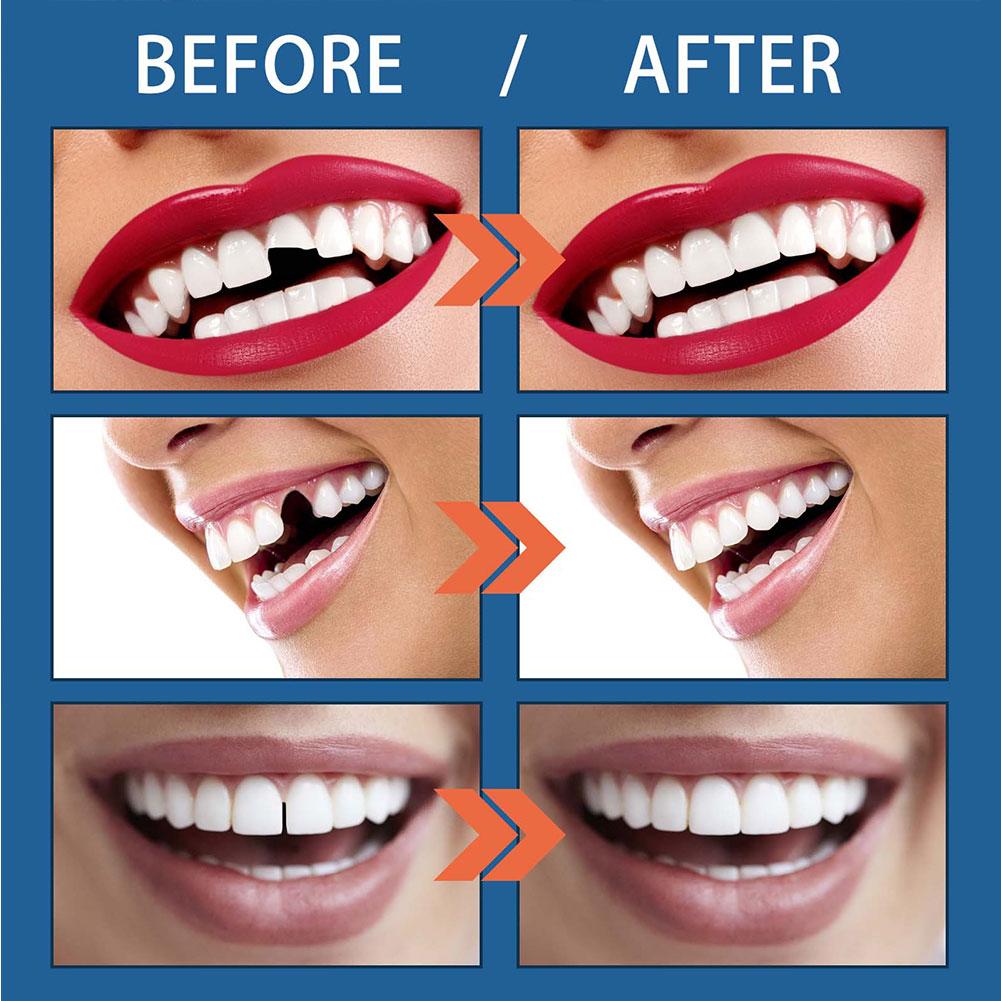 Resin 25g Temporary Tooth Repair Kit Teeth And Gaps Whitening Teeth False Tooth Adhesive Denture Teeth Solid Glue Beauty B6P6