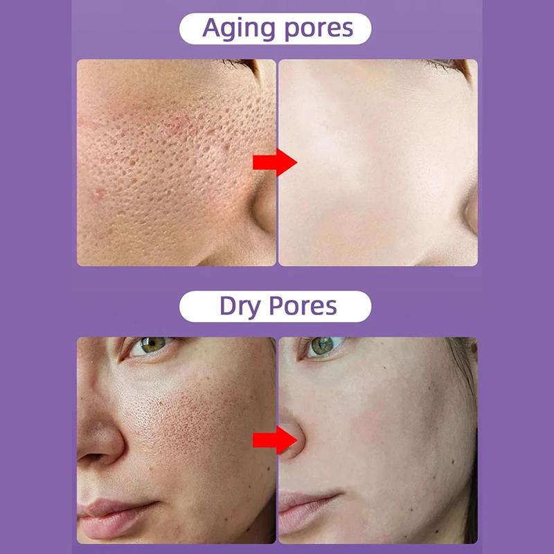 Salicylic Acid Pore Shrinking Cream Large Pores Tightening Repairing Serum Moisturizing Oil Control Skin Care Cosmetic 2024
