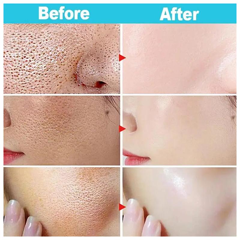 Salicylic Acid Pore Shrinking Cream Large Pores Tightening Repairing Serum Moisturizing Oil Control Skin Care Cosmetic 2024