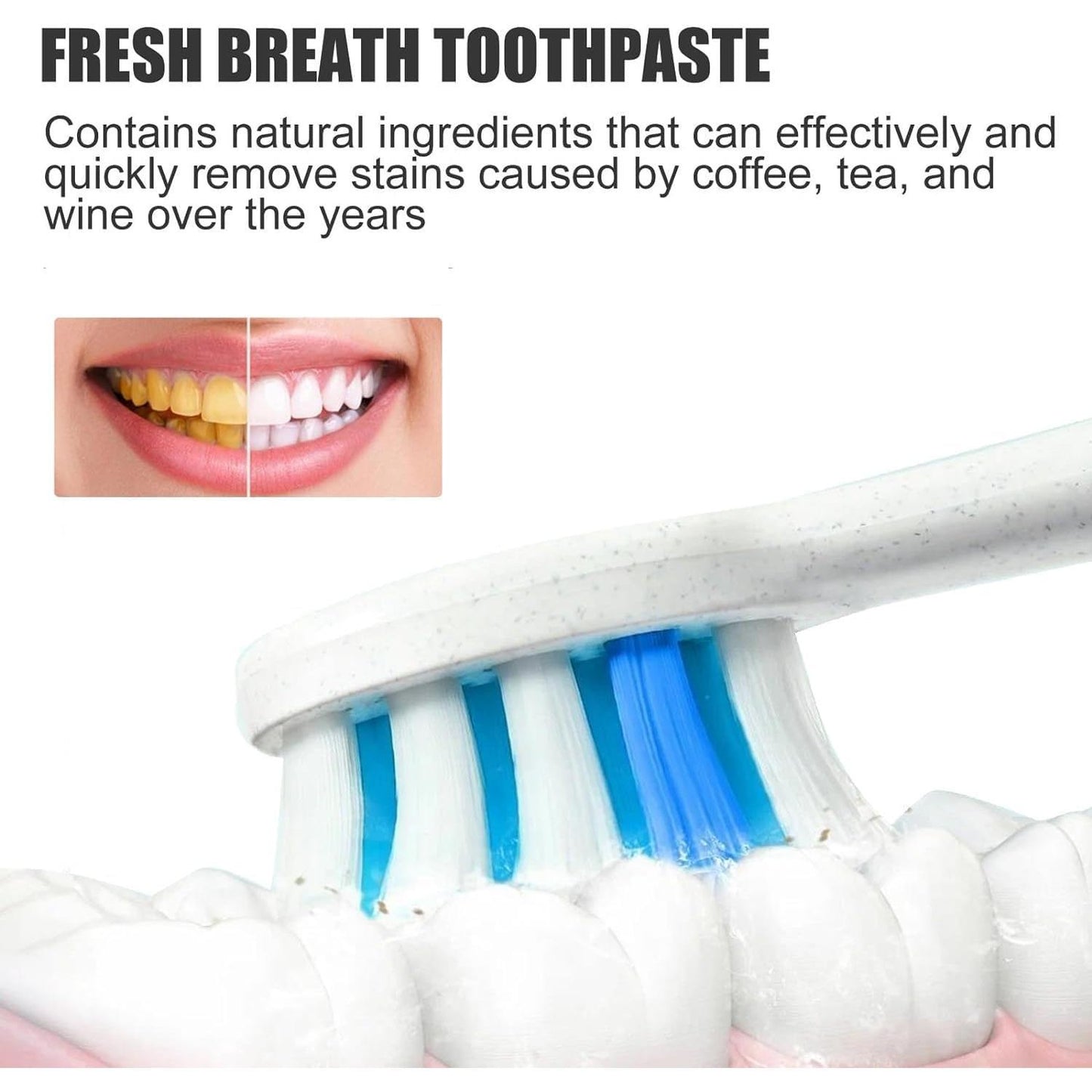 Sp-6 Ultra Whitening Toothpaste,Probiotic Sp-6 Toothpaste,SP 6 Toothpaste,Ultra Whitening Toothpaste Sp-6 (1pc)