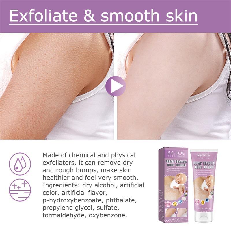 Repair Chicken Skin Body Scrub Keratosis Pilaris Lotion ffor Strawberry Legs  Dark Spot Removal KP Bump Smooth Lotion Skin Care