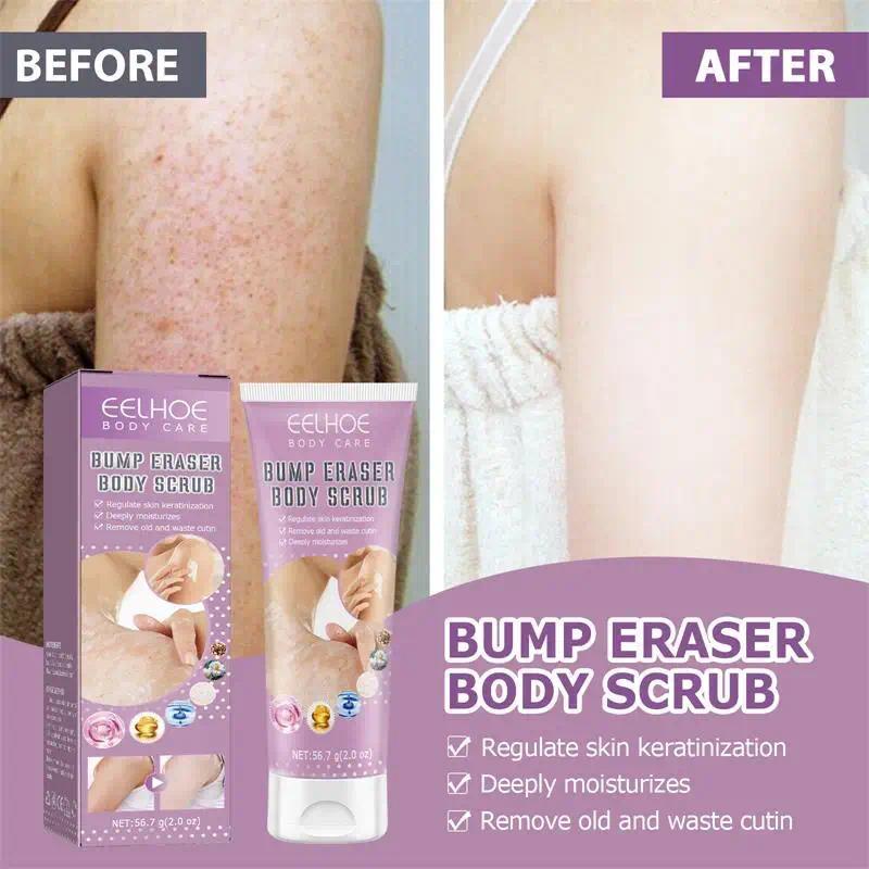 Body Scrub Mild Hair Follicle Keratinization Cream Removes Dead Skin Unblocks Pores Moisturizes Strawberry Legs Repairs Skin