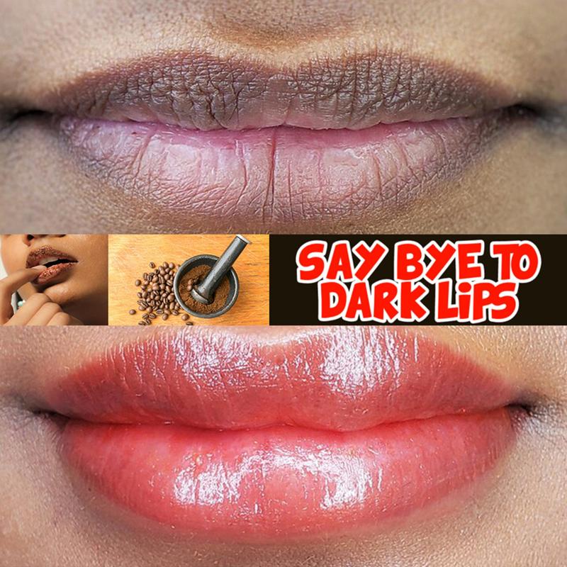 Lips Cream Fresh Pink Bleaching Treatment Remove Dark Smoke Lips Lip Balm Whitening Moisturizer Nourish Essence Dilute Melanin