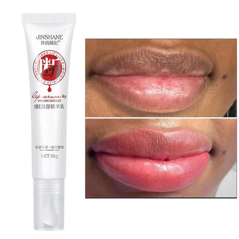Remove Dark Smoke Lips Pink Fresh Lightening Bleaching Cream Treatment Lip Balm Whitening Moisturizer Nourishing Essence Lips